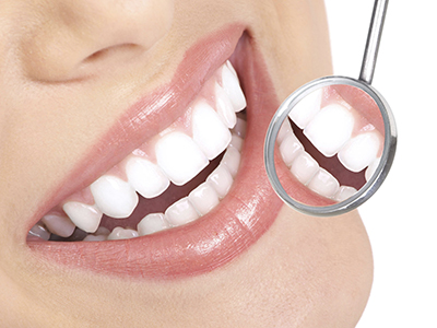 How Long Do Teeth Whitening Results Last?