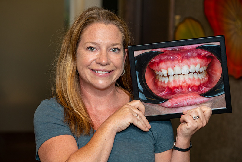 Smiling female brunette dental crown patient holding a before portrait.