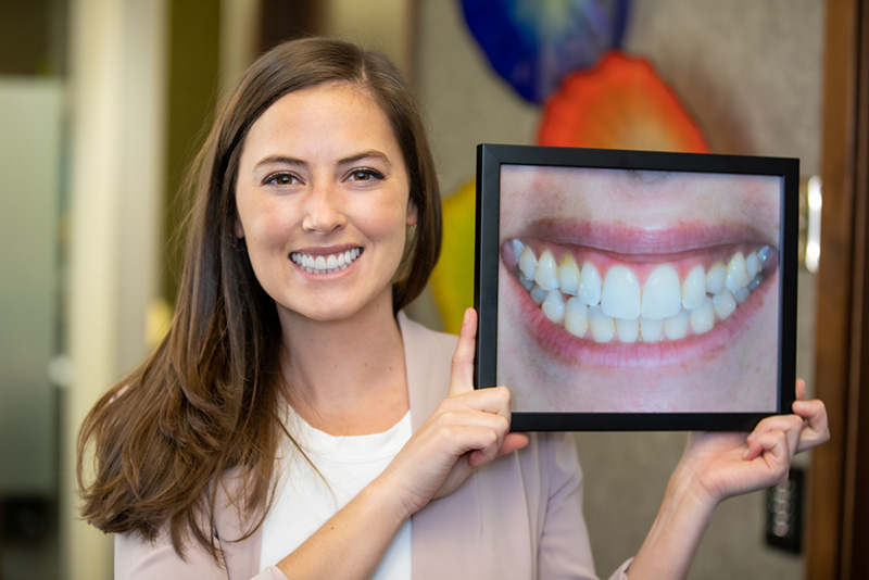 Attractive young brunette woman who completed invisalign treatment holding a before portrait.