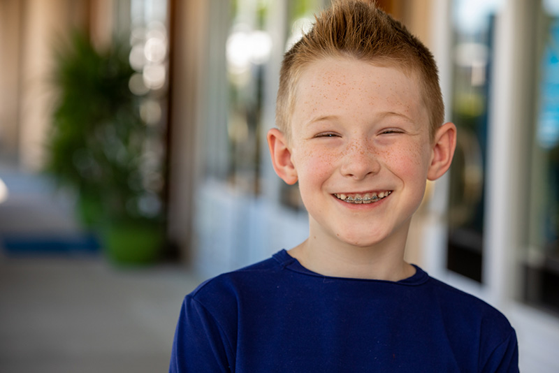 Young freckled boy in blue shirt smiling showing his orthodontic braces.