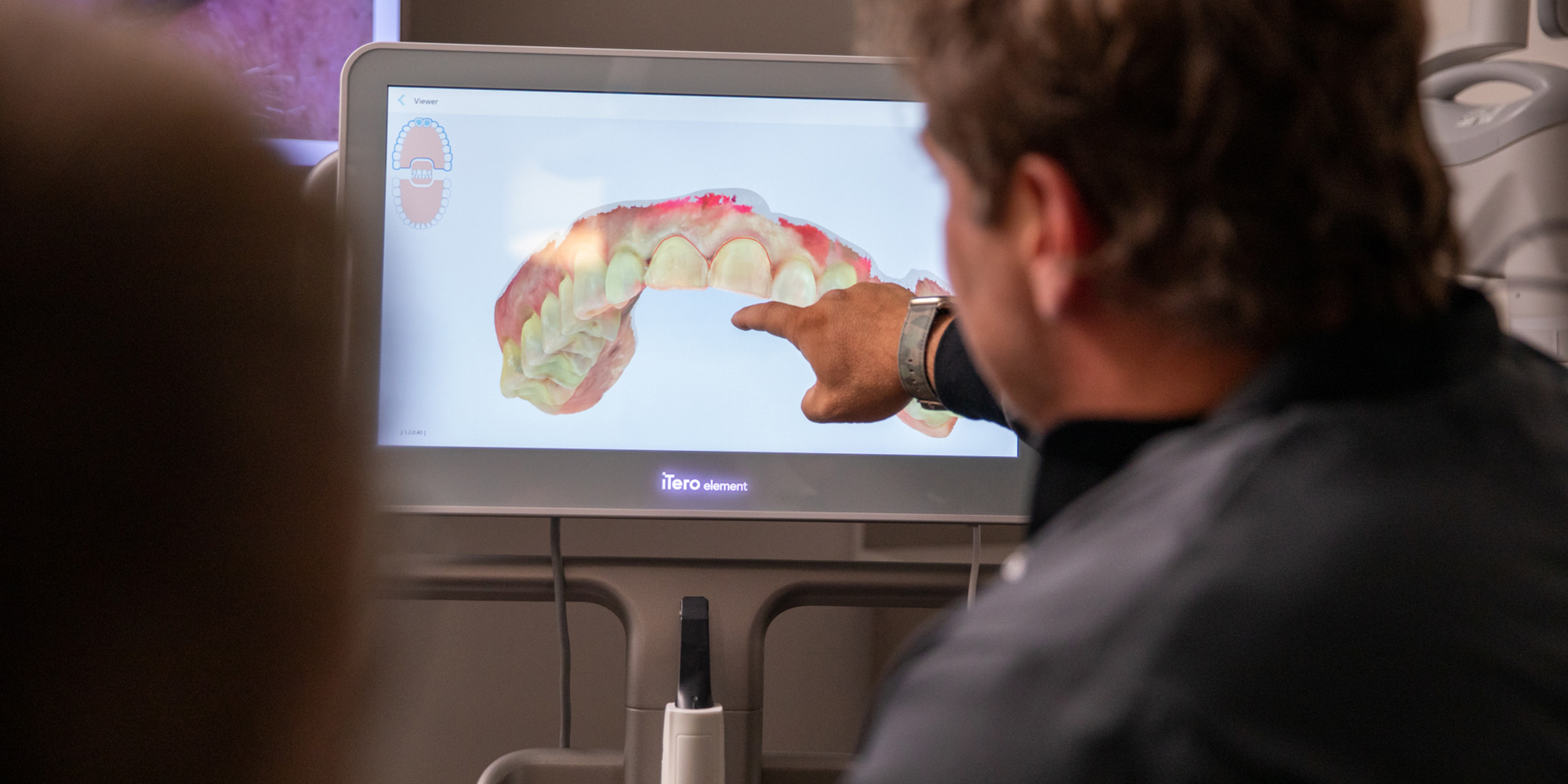 Prosthodontist Dr. Dean Kois pointing at monitor showing 3D image of a patient's upper arch.