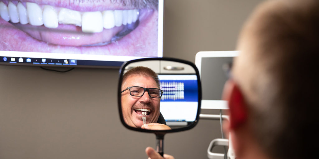 Smiling anglo male looking in mirror seeing results of repaired front tooth with porcelain veneer.