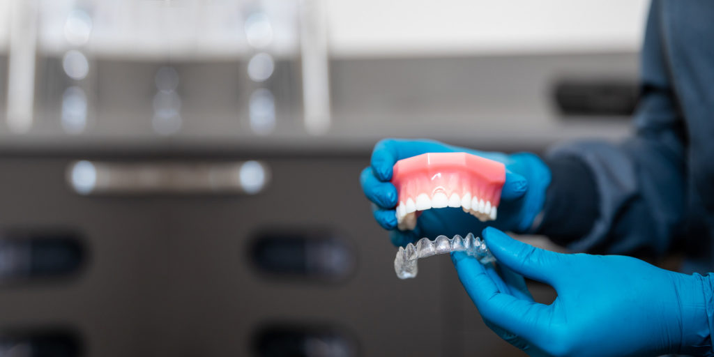 Blue gloved hands holding an upper jaw model with invisalign.