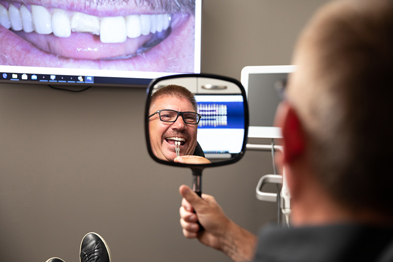 Male porcelain veneer recipient admiring his dental work in a hand-held mirror.