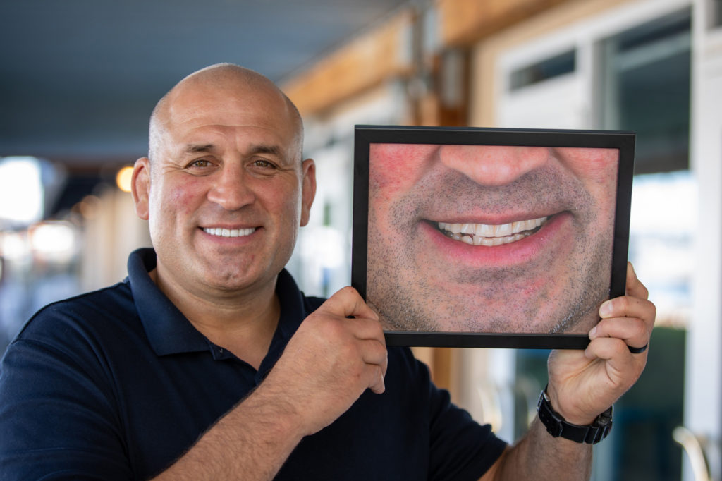 Ex-UFC fighter, Ivan Salaverry, smiling and holding a portrait of before he had full mouth dental implants.